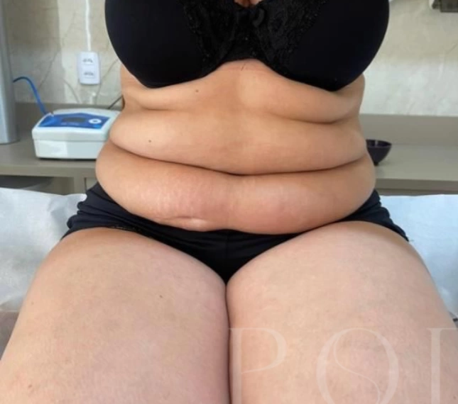 1 1