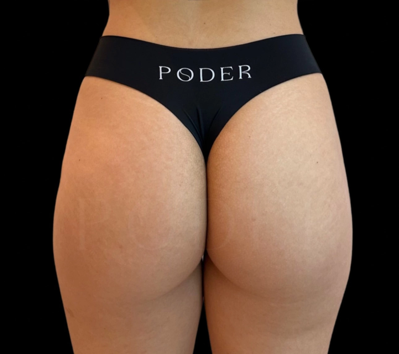 depois2